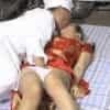 Thumbnail of related posts 197